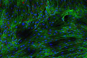 human stem cells are stained in green color.