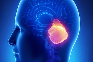 Human brain with cerebellum highlighted in yellow and orange.